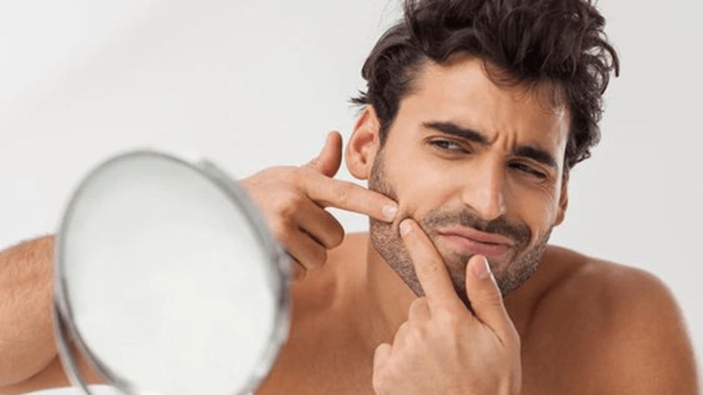 how to remove pimples naturally and permanently